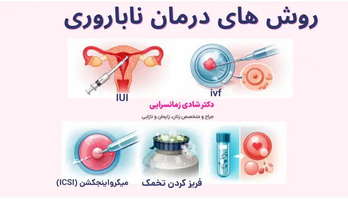 روش های درمان ناباروری