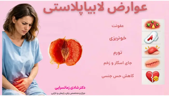 عوارض لابیاپلاستی