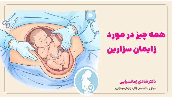 زایمان سزارین