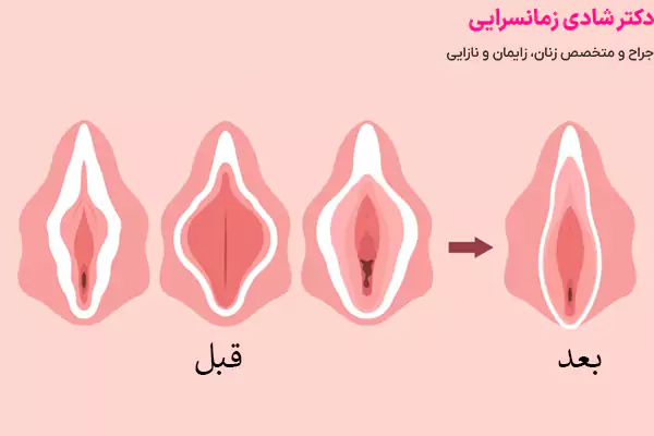 روش ترکیبی